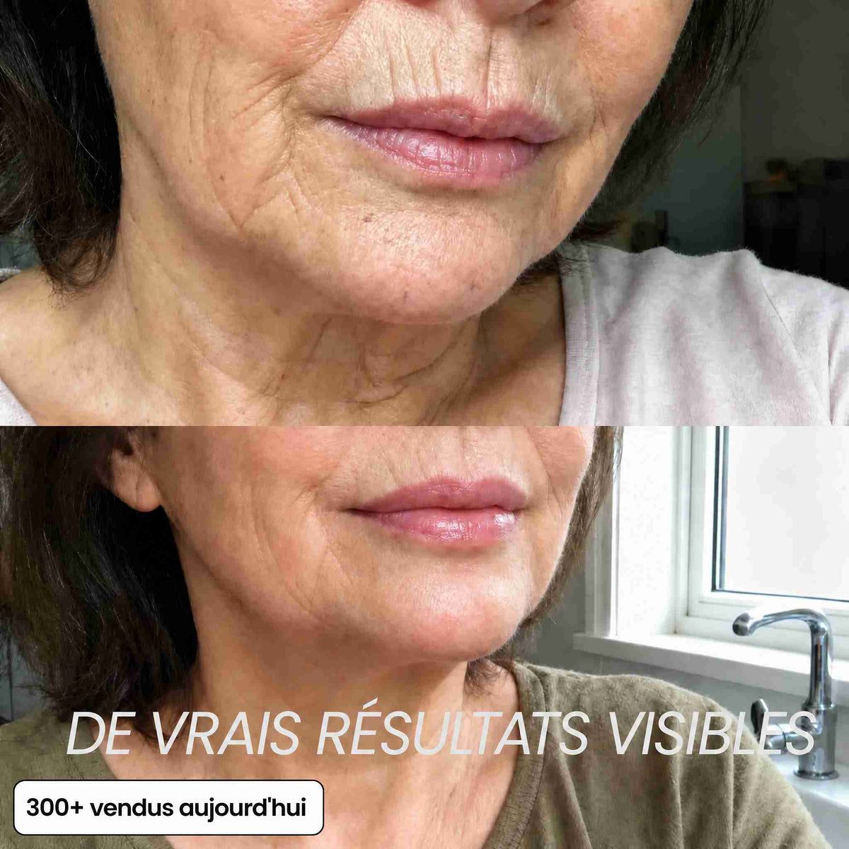 BIOALEN™ - Stick Repulpant Bio-Collagène PDRN
