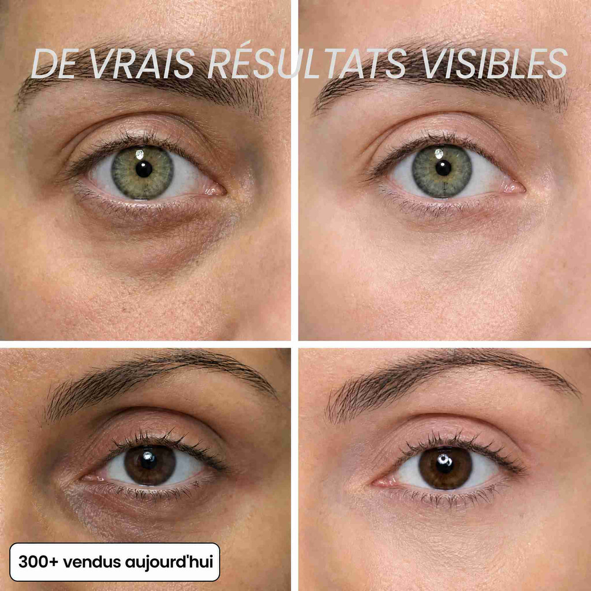 BIOALEN™ - Stick Repulpant Bio-Collagène PDRN