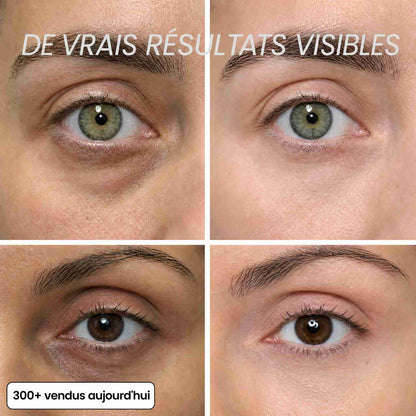 BIOALEN™ - Stick Repulpant Bio-Collagène PDRN