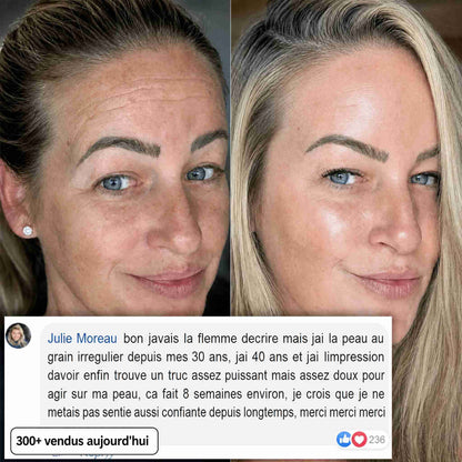 BIOALEN™ - Stick Repulpant Bio-Collagène PDRN